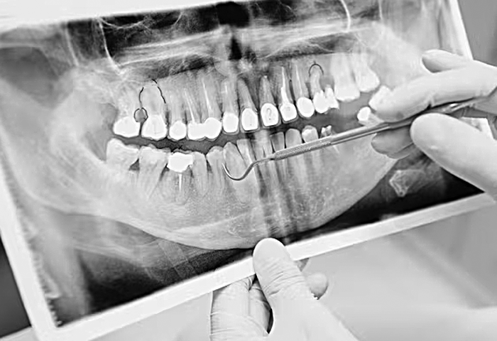 В Новосибирске за нарушения оштрафовали стоматологический Центр имплантологии