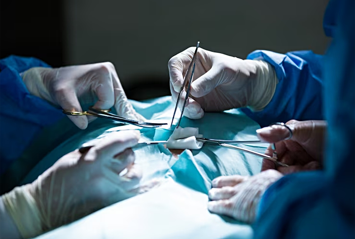 Российские хирурги достали кусок гвоздя из сердца раненного военного