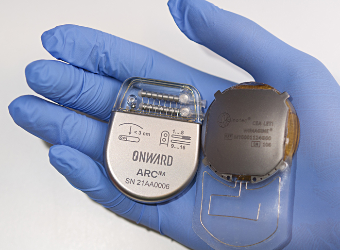 В Швейцарии успешно внедрили компьютерный чип в мозг парализованного человека