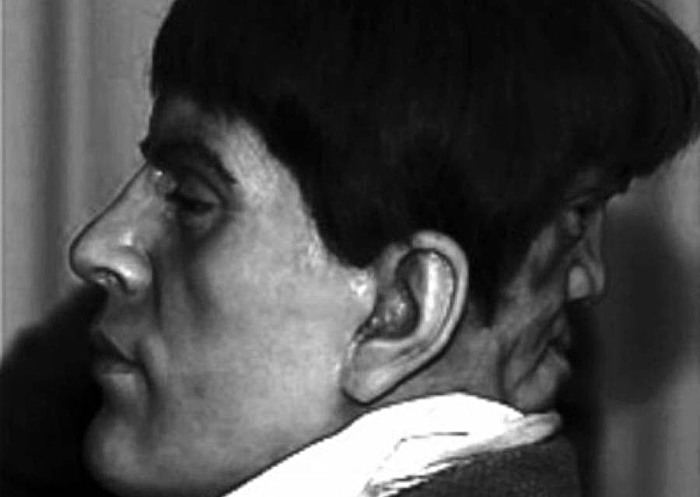 Ребёнок дьявола: страшная тайна человека с двумя лицами Эдварда Мордрейка